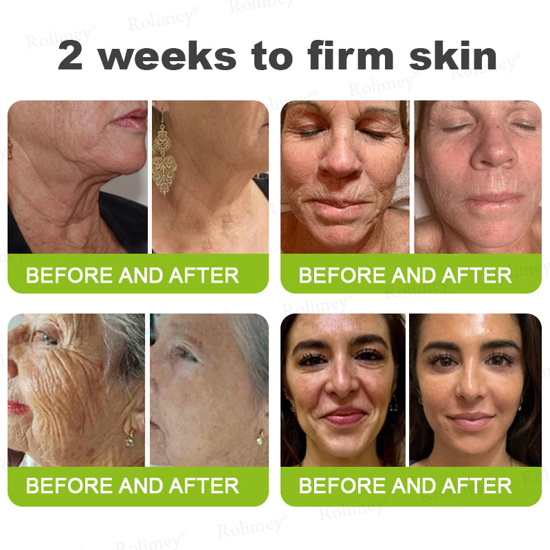 ✨💫Rolimey® Wrinkle-Lift Tightening cream 2