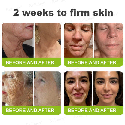 ✨💫Rolimey® Wrinkle-Lift Tightening cream 2