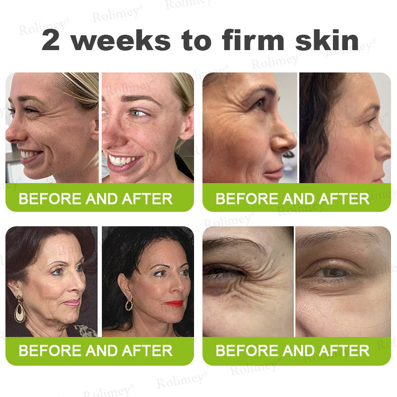 ✨💫Rolimey® Wrinkle-Lift Tightening cream 2