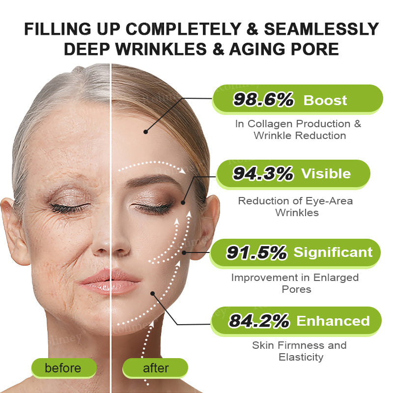 ✨💫Rolimey® Wrinkle-Lift Tightening cream 2