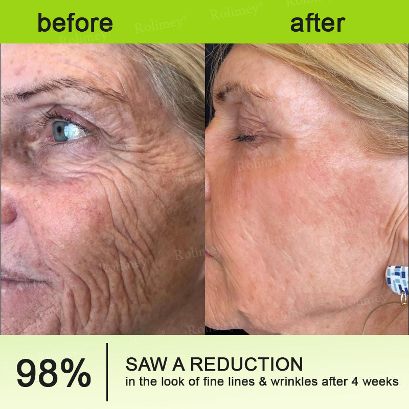 ✨💫Rolimey® Wrinkle-Lift Tightening cream 2
