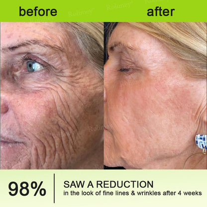 ✨💫Rolimey® Wrinkle-Lift Tightening cream 2