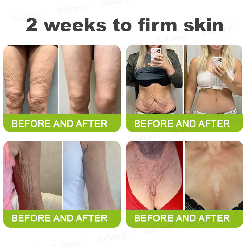 ✨💫Rolimey® Wrinkle-Lift Tightening cream 2