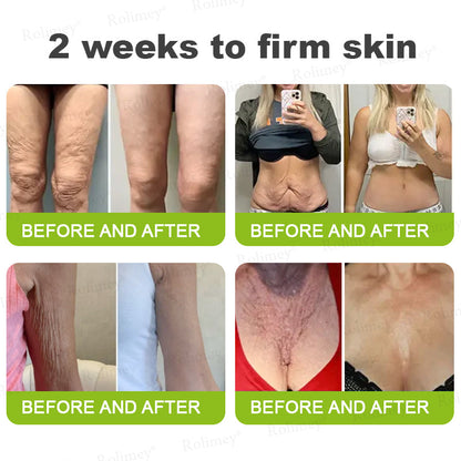 ✨💫Rolimey® Wrinkle-Lift Tightening cream 2
